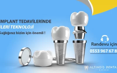KAYSERi İMPLANT