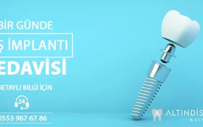 KAYSERİ İMPLANT FİYATLARI 2024