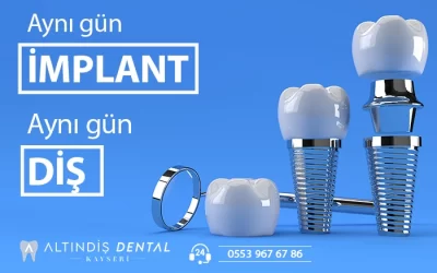 Bir günde implant diş